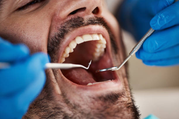 Dentist for Dental Trauma in AZ